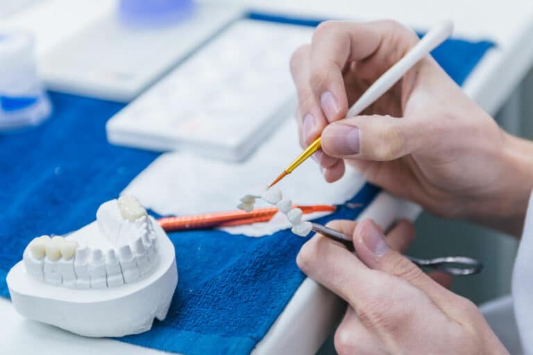 Les différents types de traitement dentaire - 2023